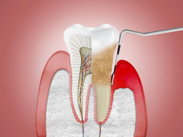 https://makeoverdentalstudio.com.mx/wp-content/uploads/2021/06/61586906_308516726738739_2764837694461706240_n-640x480.jpg
