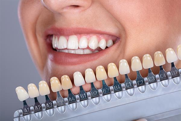 https://makeoverdentalstudio.com.mx/wp-content/uploads/2021/06/blanqueamiento-dental-profesional-en-armilla-clinica-dental-antonio-cutando.jpg