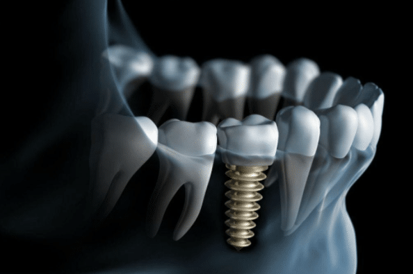 https://makeoverdentalstudio.com.mx/wp-content/uploads/2021/06/captura-de-pantalla-2020-05-26-a-las-16.33.06.png