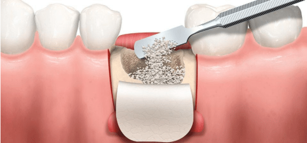 https://makeoverdentalstudio.com.mx/wp-content/uploads/2021/06/captura-de-pantalla-2020-07-22-a-las-22.55.17.png