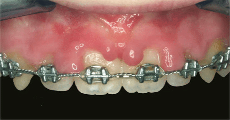 https://makeoverdentalstudio.com.mx/wp-content/uploads/2021/06/captura-de-pantalla-2020-08-14-a-las-11.59.33-1.png