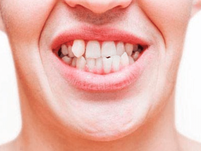 https://makeoverdentalstudio.com.mx/wp-content/uploads/2021/06/captura-de-pantalla-2021-02-26-a-las-21.28.01-640x480.png