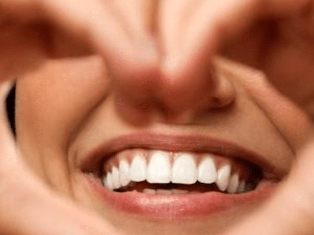 https://makeoverdentalstudio.com.mx/wp-content/uploads/2021/06/captura-de-pantalla-2021-04-09-a-las-11.09.33-640x480.png
