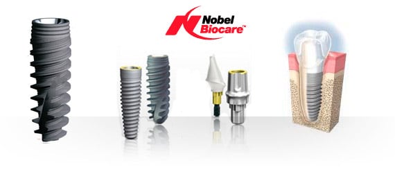 https://makeoverdentalstudio.com.mx/wp-content/uploads/2021/06/implante_nobel.jpg