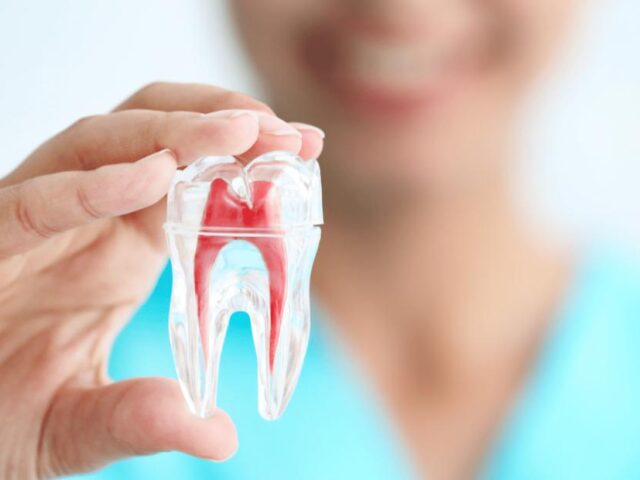 https://makeoverdentalstudio.com.mx/wp-content/uploads/2021/06/whatsapp-image-2020-04-28-at-6.06.05-pm-640x480.jpeg