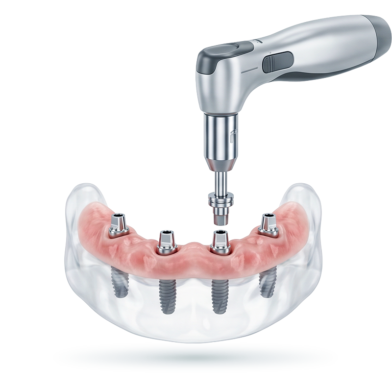 Render of a driver seating abutments on implants