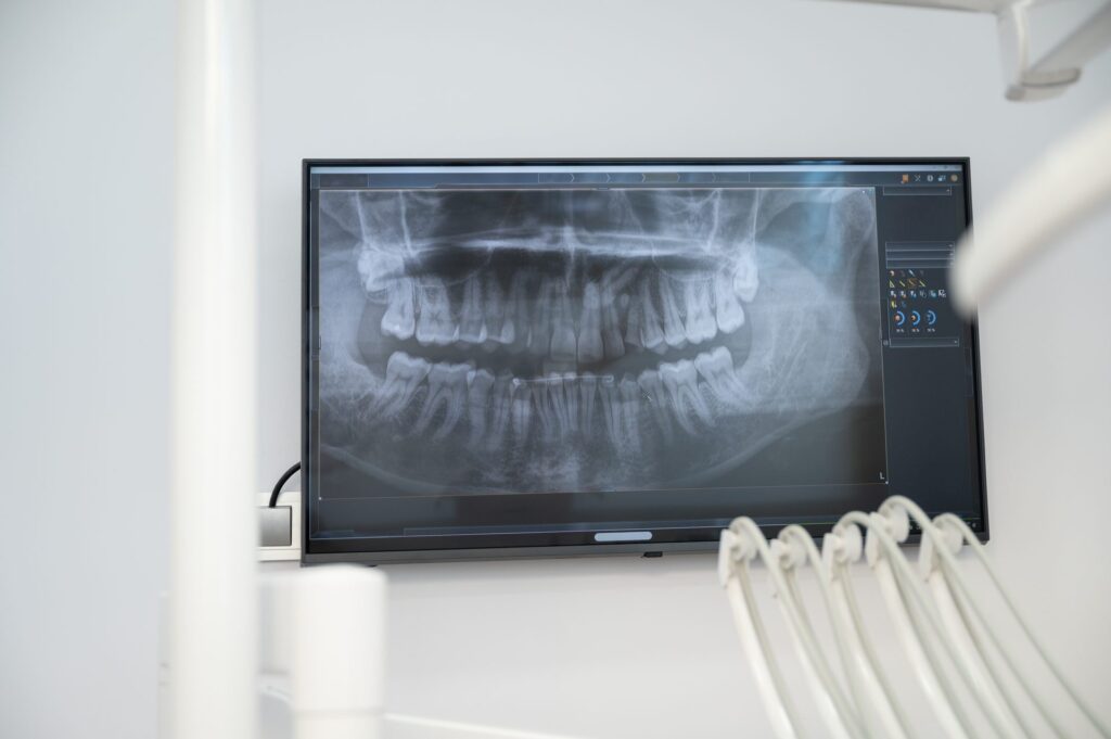 Screen showing a panoramic x-ray next to the dental unit