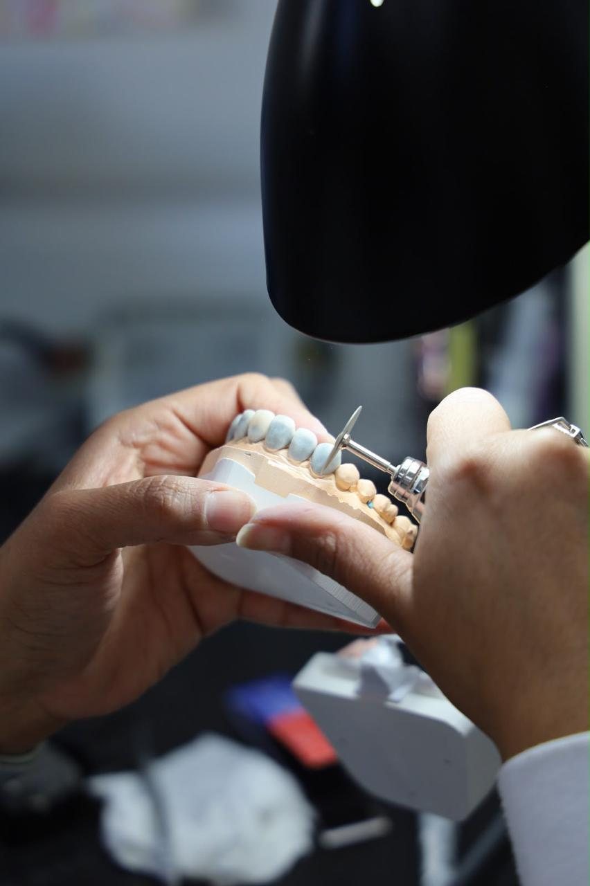 Work in progress at the in-house dental laboratory of Makeover Dental Studio