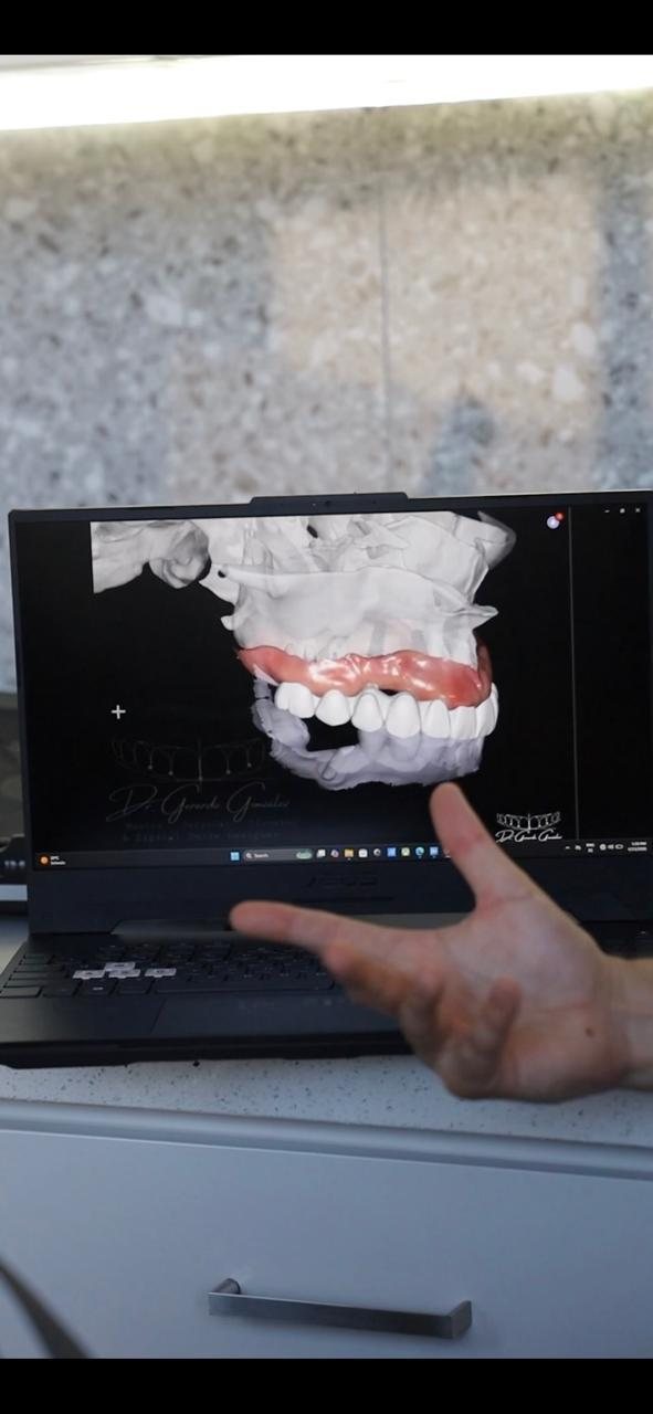 Digital implant planning on a three-dimensional model at Makeover Dental Studio