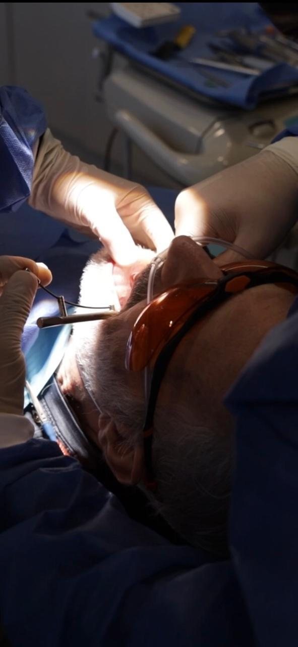 Implant surgery in progress at Makeover Dental Studio in Tijuana