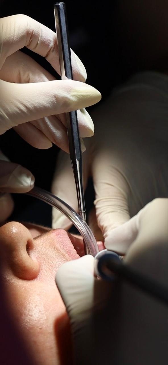 Intraoral scan being taken at Makeover Dental Studio in Tijuana