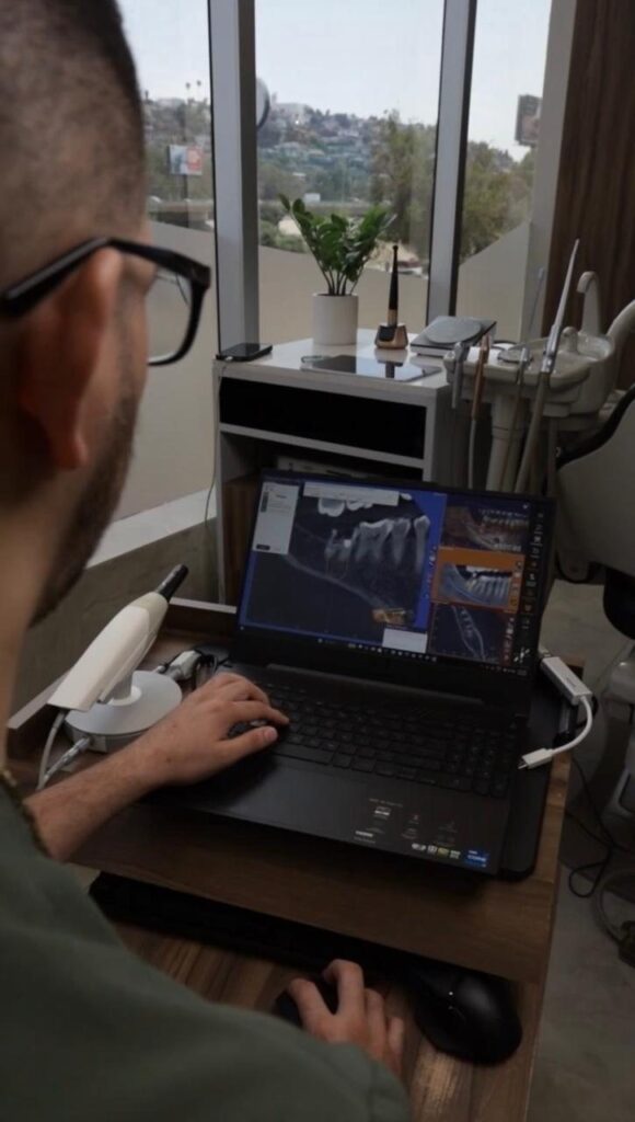 Treatment planning on screen at Makeover Dental Studio in Tijuana
