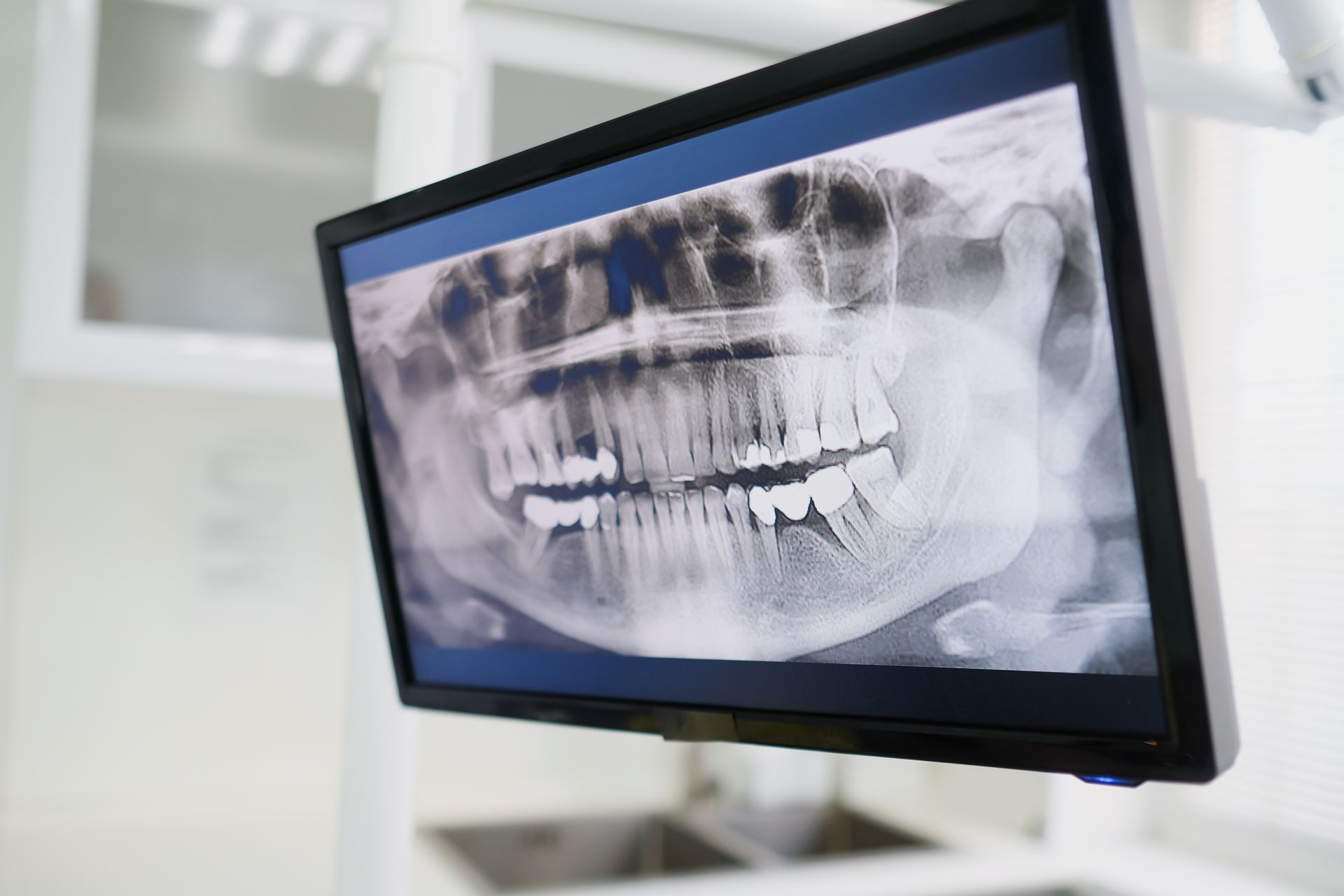 Large screen showing a panoramic x-ray in a treatment room