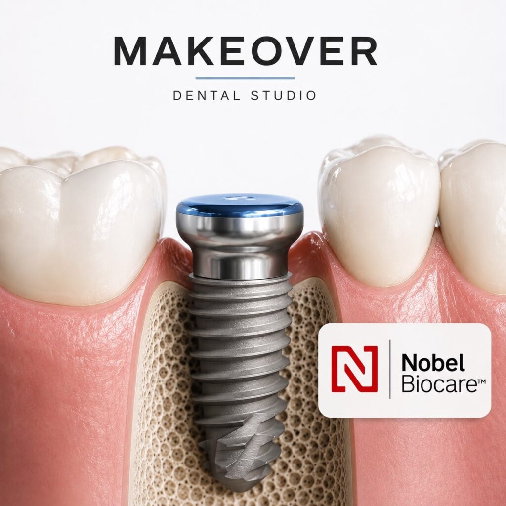 Nobel Biocare implant osseointegration Makeover Dental Studio, Tijuana