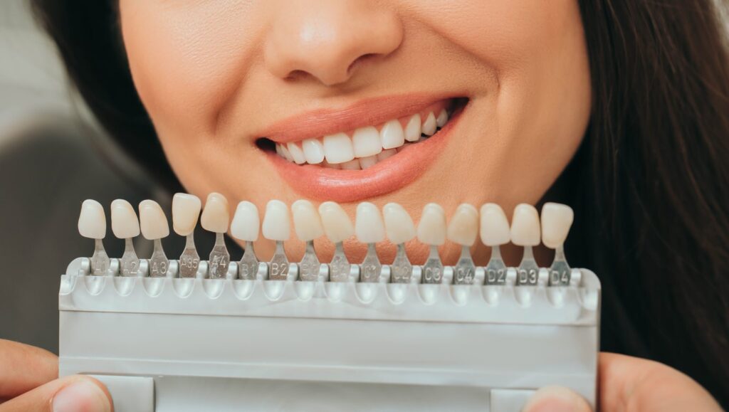 Woman 's beautiful smile and dental shade guide, Tijuana
